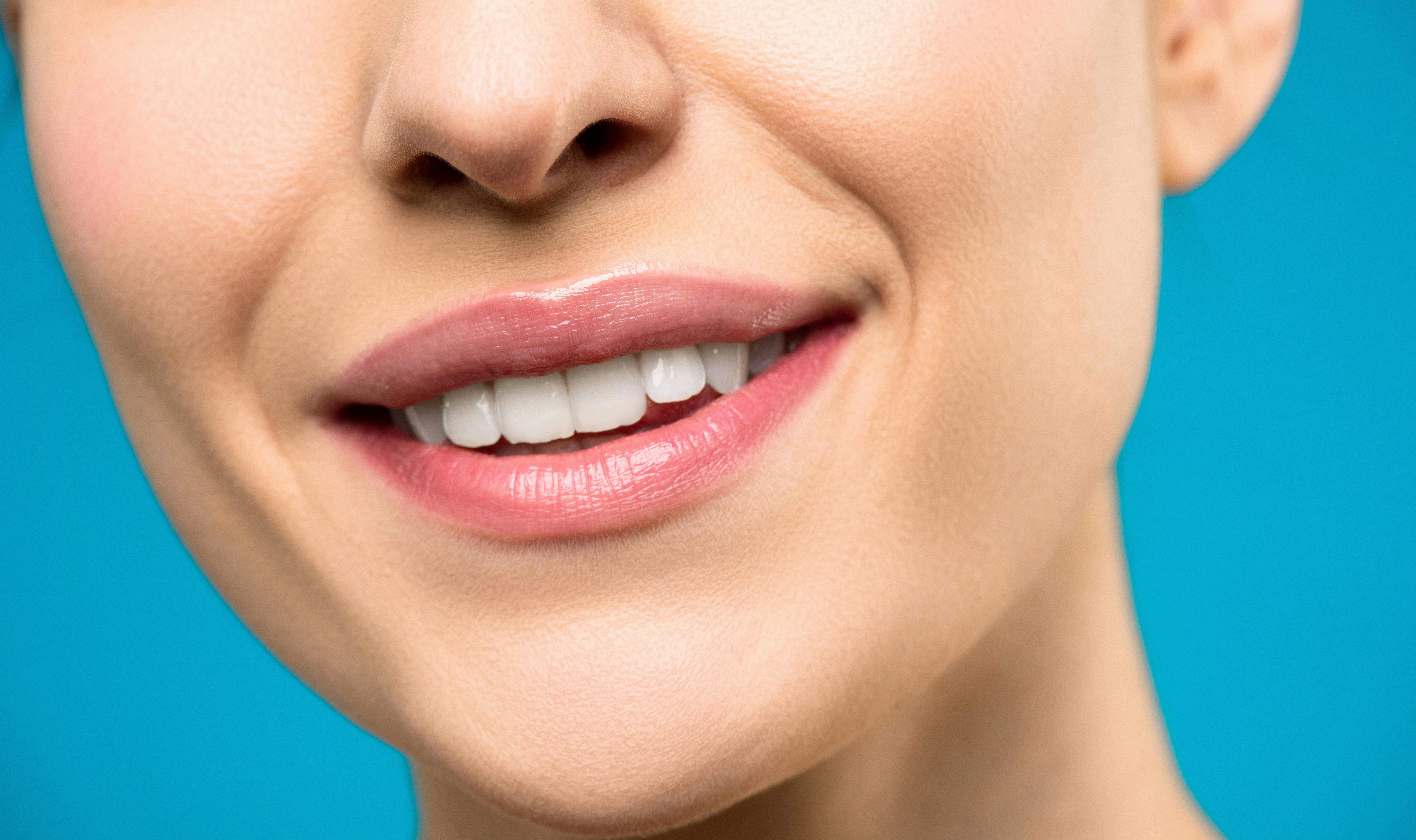 Teeth Whitening in Howick